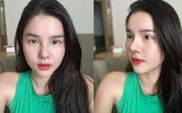 Kỳ Hân vừa sửa mũi, nhan sắc hiện tại ra sao?